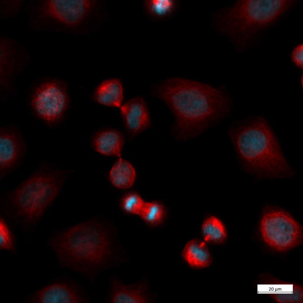 Zeiss Axiovert5 Fluoreszenz